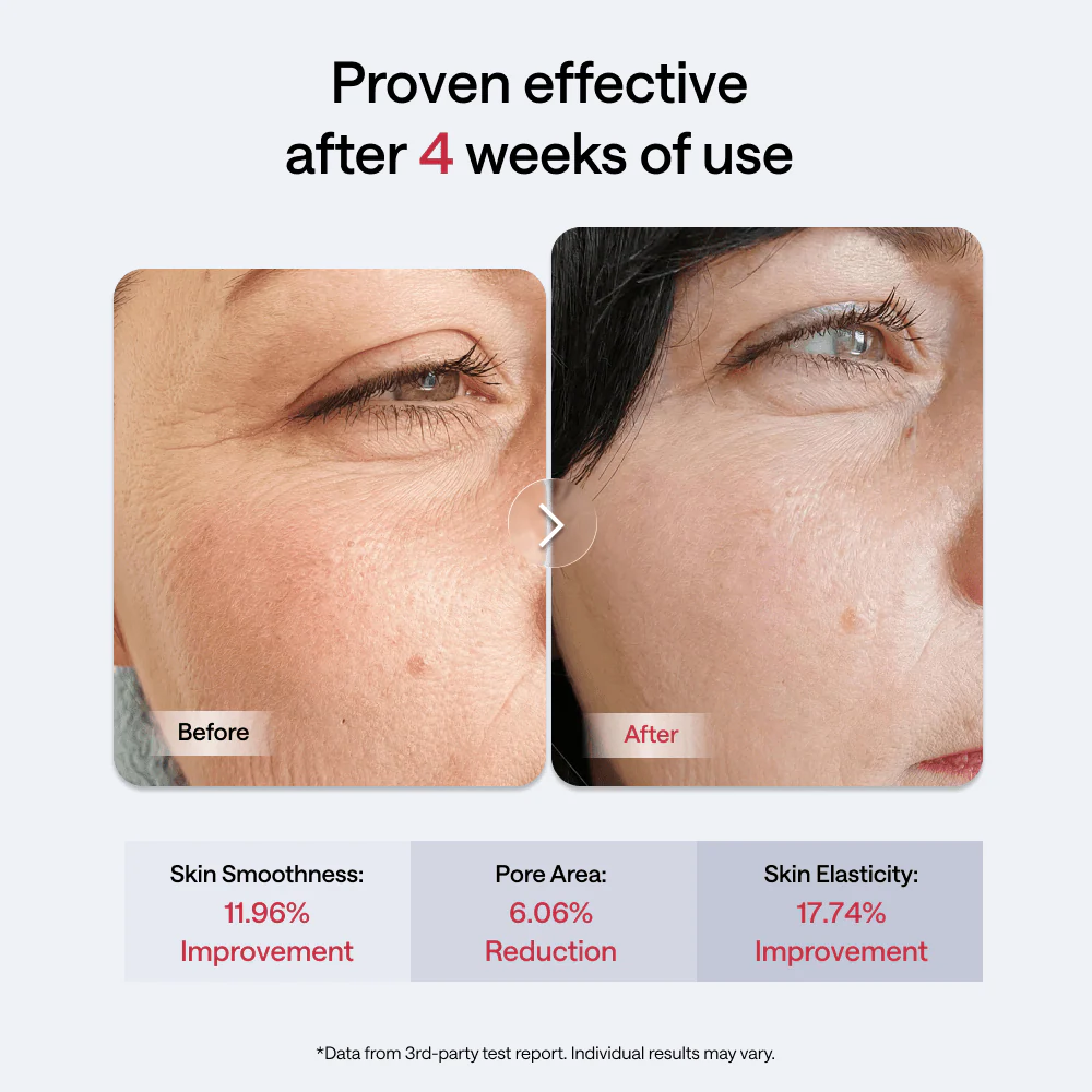 JMOON by Ulike Transdermal EM50 - Image 3